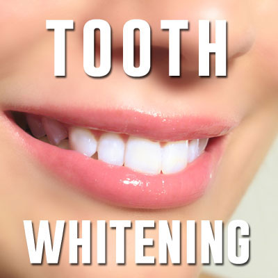 Tooth Whitening from Staveley Dental Care