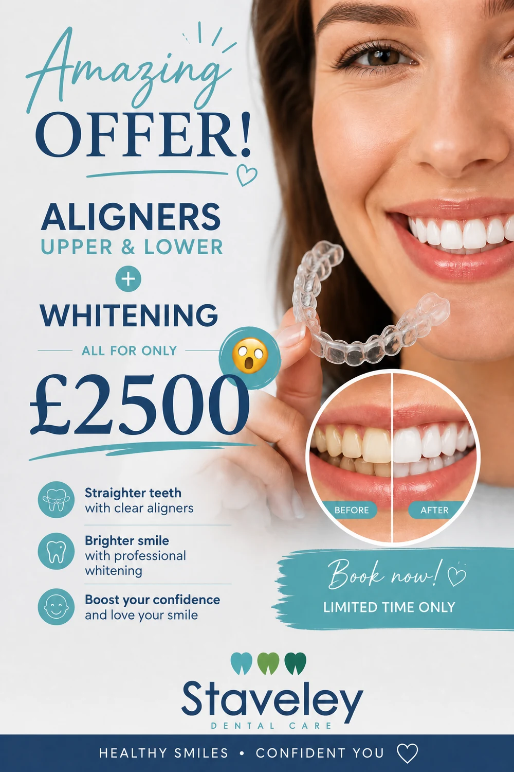 Amazing offer: aligners upper and lower plus whitening for £2500 at Staveley Dental Care